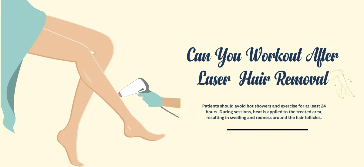 Can-You-Workout-After-Laser-Hair-Removal.webp